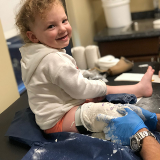pediatric leg casting